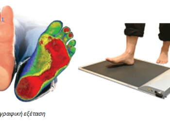 ΔΩΡΕΑΝ Εξέταση Ανάλυσης Βαδίσματος για τους πολίτες του Δήμου Αιγάλεω